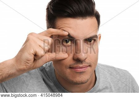 Man Checking His Health Condition On White Background, Closeup. Yellow Eyes As Symptom Of Problems W
