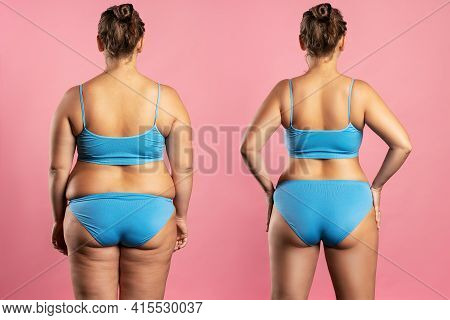 Woman's Body Before And After Weight Loss, Plastic Surgery Concept On Pink Background