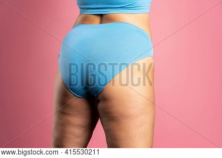 Overweight Woman With Fat Hips And Buttocks, Obesity Female Body On Pink Background