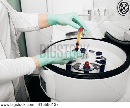 Plasmolifting Process. Preparation Of Blood For Injections. Cosmetologist Puts Tube Of Blood In A Ce
