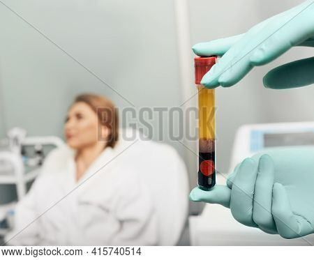 Test Tube With Blood Plasma In Beauticians Hands For Plasmolifting, Over Background Woman Patient At