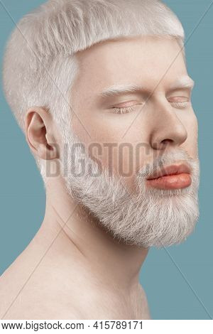 Albinism Concept. Headshot Of Young Albino Man With Closed Eyes, Pale Skin And White Hair Posing On 
