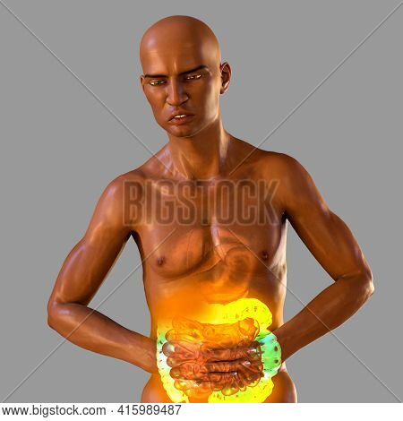 Abdominal Pain And Cramping In African Man Because Of Irritable Bowel Syndrome, Conceptual 3d Illust