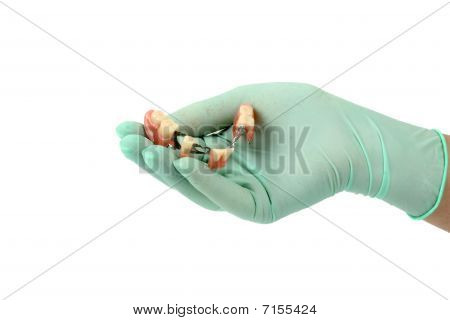 Zahnersatz auf einer hand