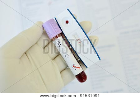 HIV positive