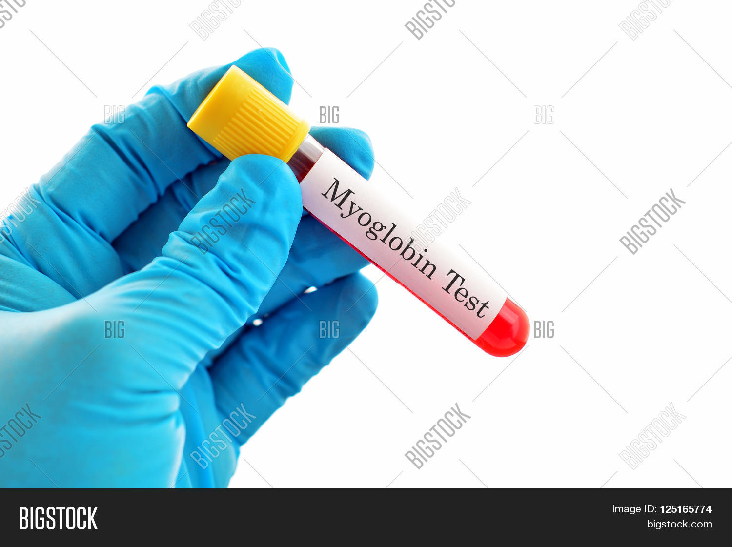 Test Tube Blood Sample Image & Photo (Free Trial) Bigstock