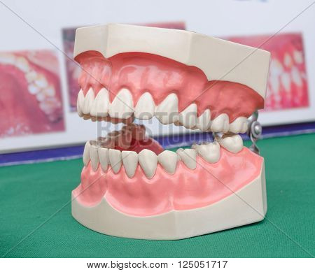 Dentoform ,Dental model for demonstration in dentist clinic