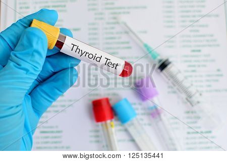 Test tibe with blood sample for thyroid hormone test