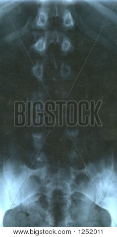 Radiografia della colonna vertebrale