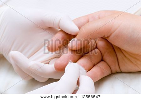 มือของแพทย์และผู้ป่วย