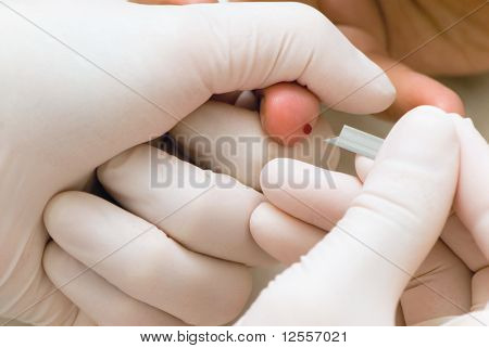 อย่างใกล้ชิดของนิ้วสำหรับการวิเคราะห์เลือด