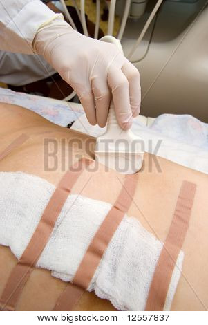bir mide kadının kliniğinde ameliyat sonrası gözetim
