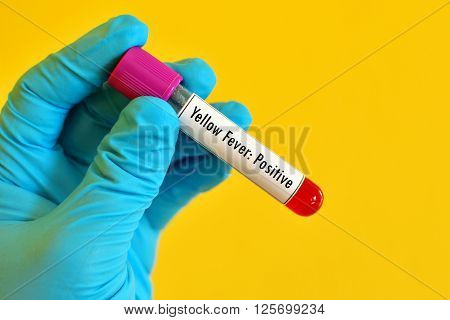 Blood sample positive with yellow fever test