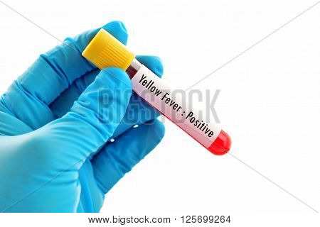 Blood sample positive with yellow fever test
