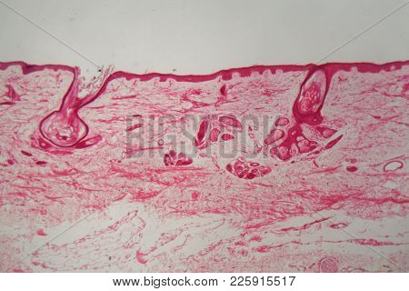 Skin With Follicle Under The Microscope