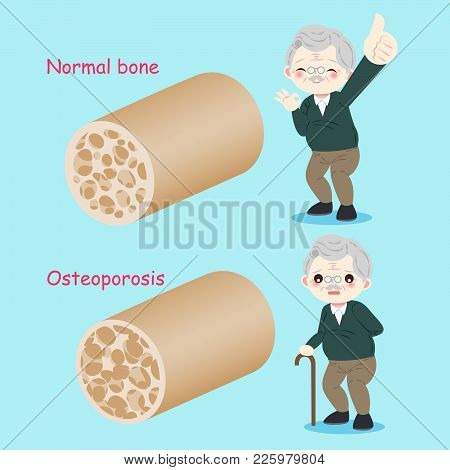 Old Man With Osteoporosis On The Blue Background