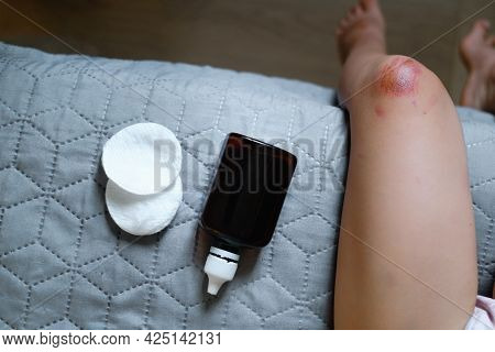 Helping A Child Perform First Aid Knee Injury After She Had An Accident. Using Antiseptic Chlorhexid