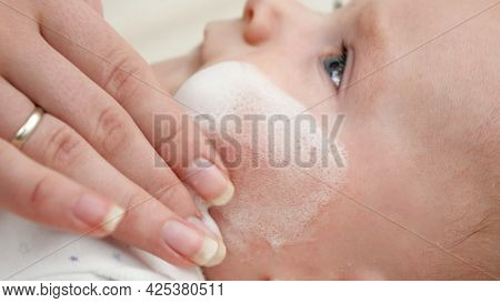 Closeup Of Applying Moisturizing Creme On Baby Sking Suffering From Dhermatitis