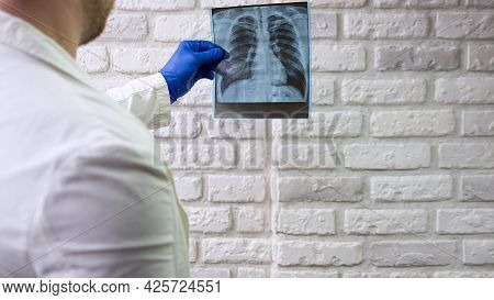 A Healthcare Professional Examines A Chest X-ray At The Clinic. Chest X-ray Of A Person In The Hands