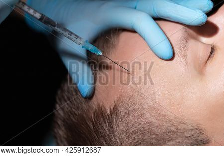 The Doctor Makes An Injection Of Homeopathic Mesotherapy Hair Of The Skin On The Man's Head. Baldnes