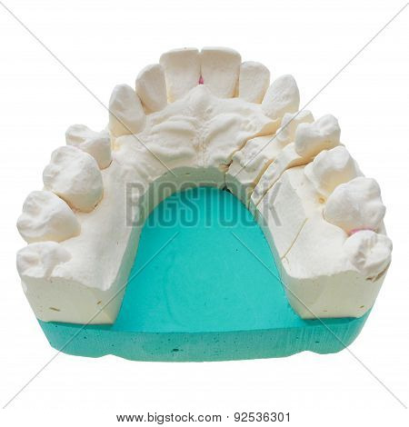 Positive Teeth Cast