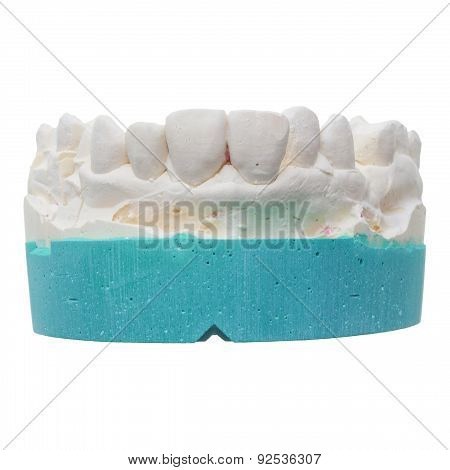 Positive Teeth Cast