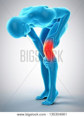 3d rendered, medically accurate 3d illustration of knee pain