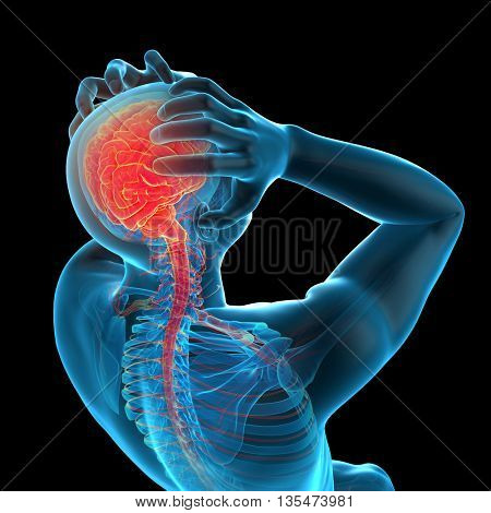 3d rendered, medically accurate 3d illustration of headache/ migraine