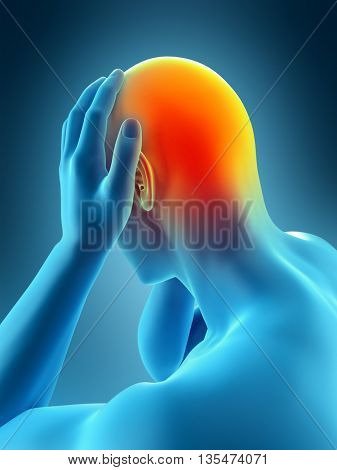 3d rendered, medically accurate 3d illustration of headache/ migraine
