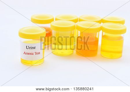 Urine sample for arsenic (Heavy metals) test