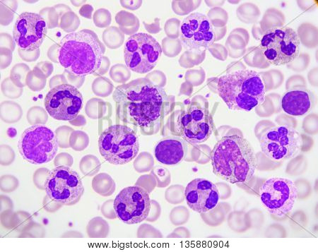 White blood cell in peripheral blood smear, Wright stain