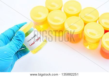 Urine sample for lead (heavy metal) test