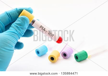 Blood sample with PSA (Prostate-specific antigen) positive