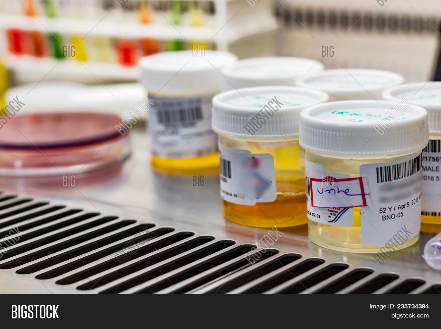 Many Urine Samples Image & Photo (Free Trial) Bigstock