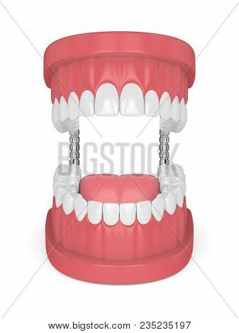 3D Render Of Jaw Model With Teeth Over White