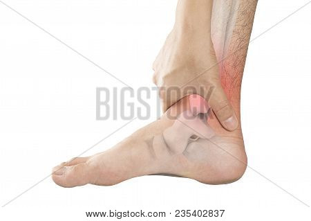 Foot Bones Pain White Background Foot Injury