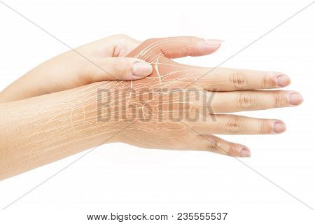 Finger Muscle Pain White Background Finger Injury