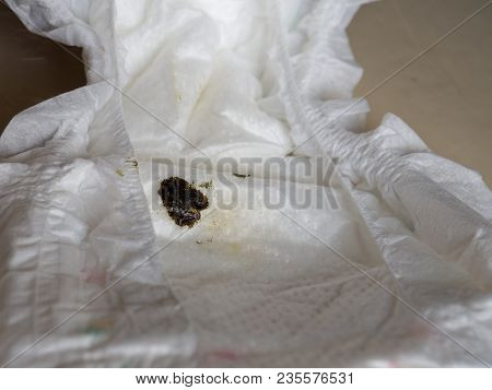Excrement Of Newborn Or Medical Called Meconium. It Is A Waste Of The Body In The Newborn. The Mecon