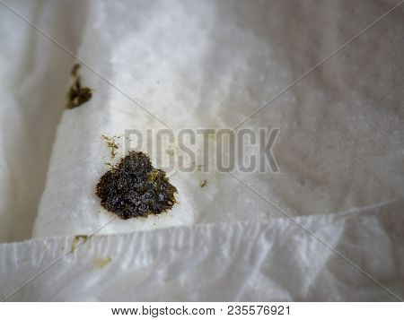 Excrement Of Newborn Or Medical Called Meconium. It Is A Waste Of The Body In The Newborn. The Mecon