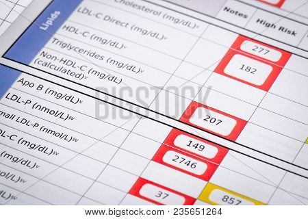 red flags for high risk cholesterol  - a detail of blood laboratory screening results with focus on lipids panel
