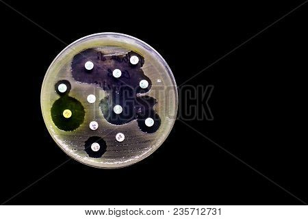 Culture Plate Of Bacterial Growth Showing Antibiotic Sensitivity In Their Colony Pattern Isolated In