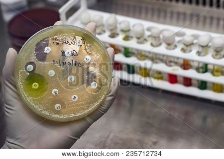Top View Of Culture Plate Of Bacterial Growth Showing Antibiotic Sensitivity In Their Colony Pattern