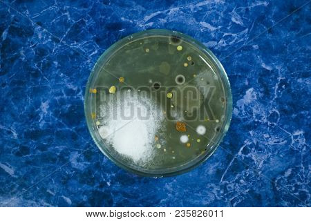 Colonies Of Bacteria On A Petri Dish. Cocci, Bacilli. Mold Next To Bacteria Colonies. Human Hygiene.