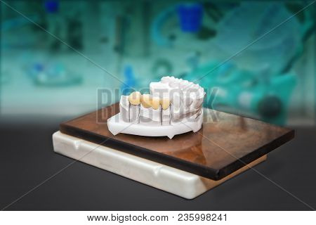 Technical Shots Of Gypsum Model With Ceramic Teeth On A Dental Prothetic Laboratory