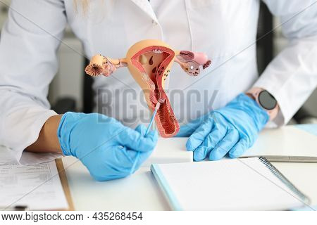 Gynecologist Holds Model Of Female Reproductive System And Cytological Brush