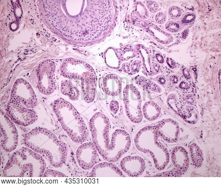 Human Axilla Skin Showing Secretory Units Of Eccrine (top Right) And Apocrine Sweat Glands. The Last