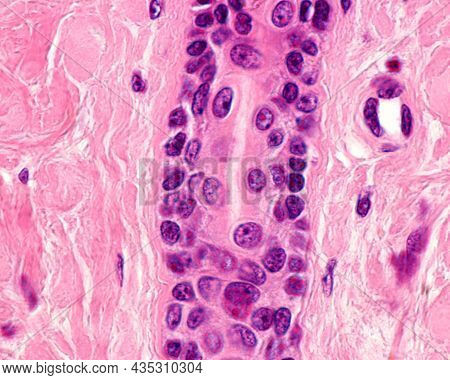 Intradermal Portion Of Excretory Duct Of An Eccrine Sweat Gland, Lined By A Stratified Epithelium Fo