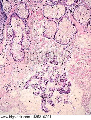 Differences In The Location In The Skin Of Sebaceous Glands (more Superficial, In Reticular Dermis) 