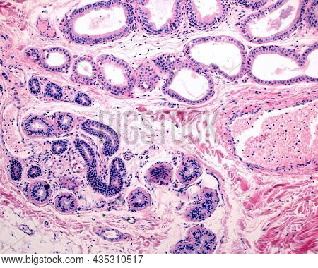 Comparison Between Secretory Units Of Eccrine (bottom) And Apocrine (top) Sweat Glands. The Last One