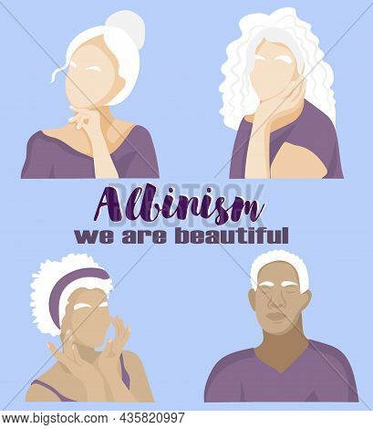 Young Guy And  Girls With Albinism. Body Positive Concept. International Albinism Awareness Day. Vec